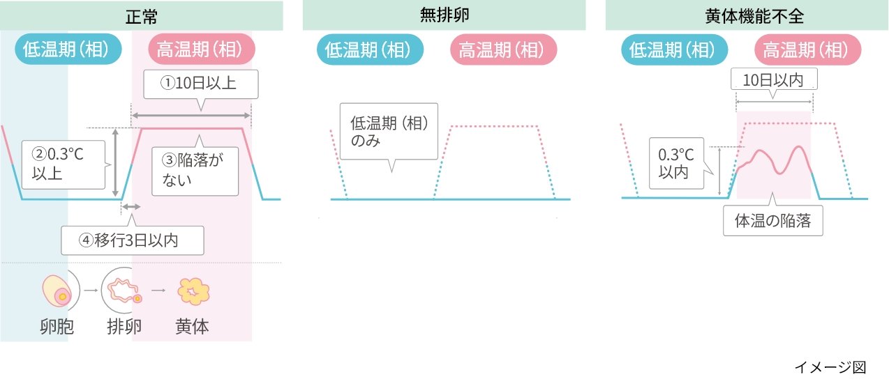 【図1】　基礎体温の変化でわかる病気